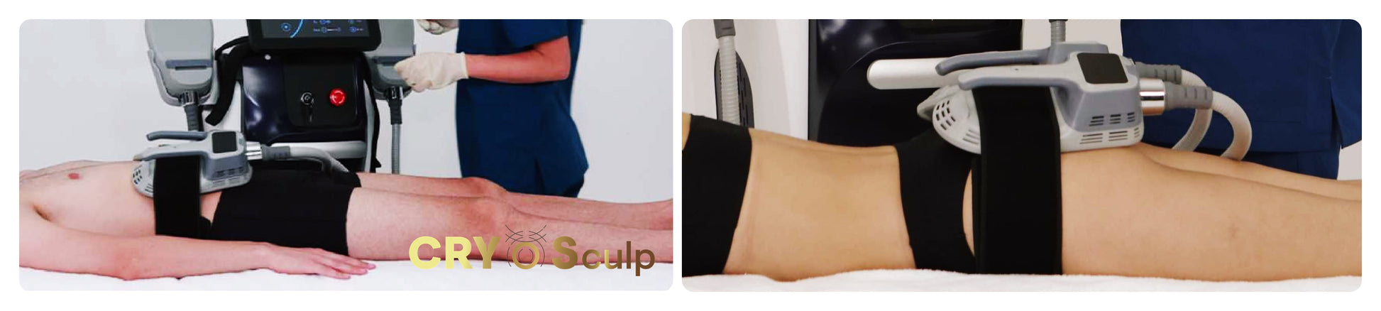 Urządzenie Kosmetyczne - CryoSculp Kriolipoliza + Fala Elektromagnetyczna