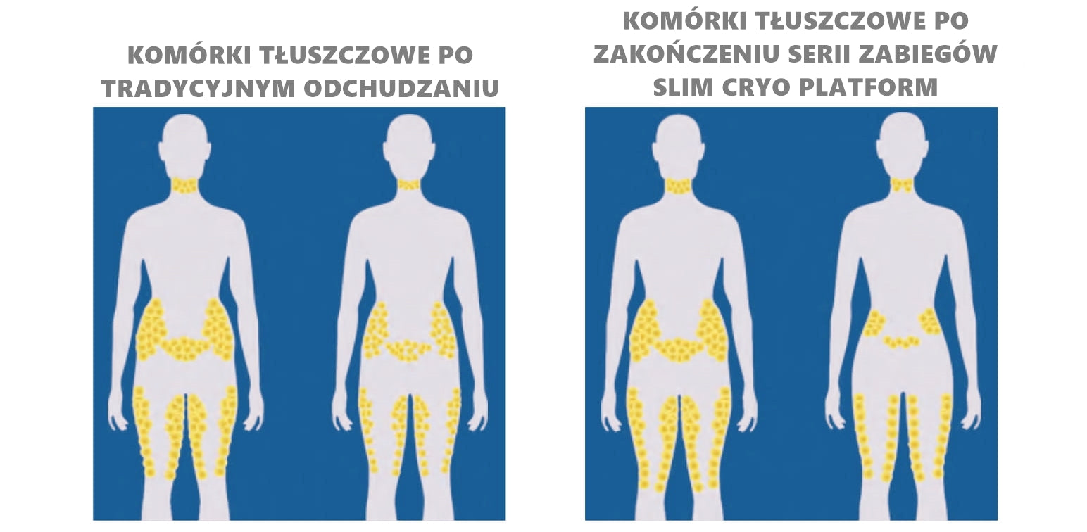Urządzenie Kosmetyczne - Slim Cryo Platform