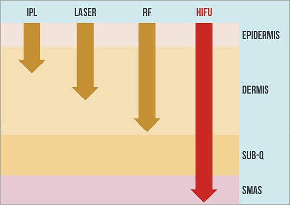 HIFU Ultralift (Wersja Nablatowa)