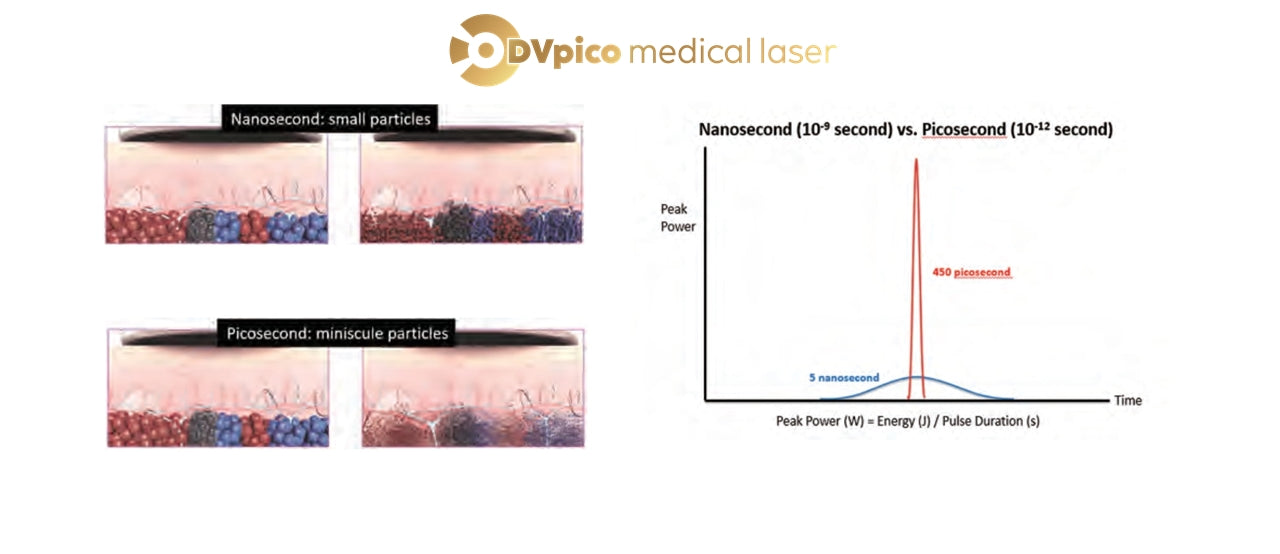 Urządzenie Medyczne -DVPico Medical Laser - Laser Pikosekundowy