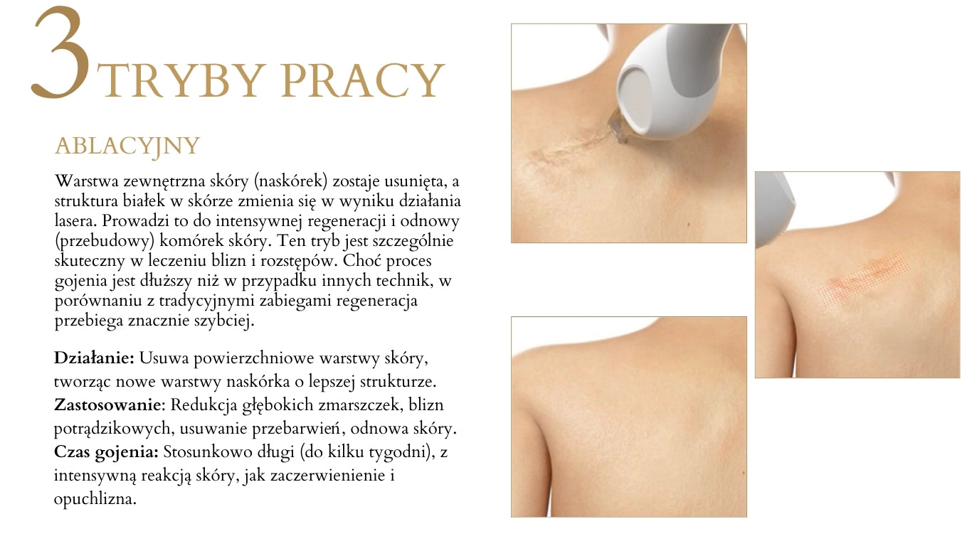 TULURAY - Laser Tulowy Wersja Nablatowa