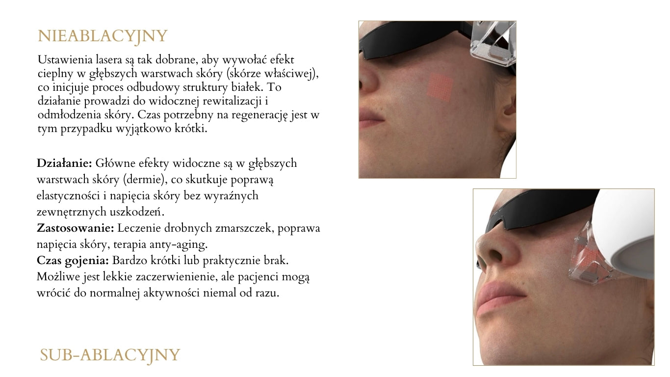 TULURAY - Laser Tulowy Wolnostojący