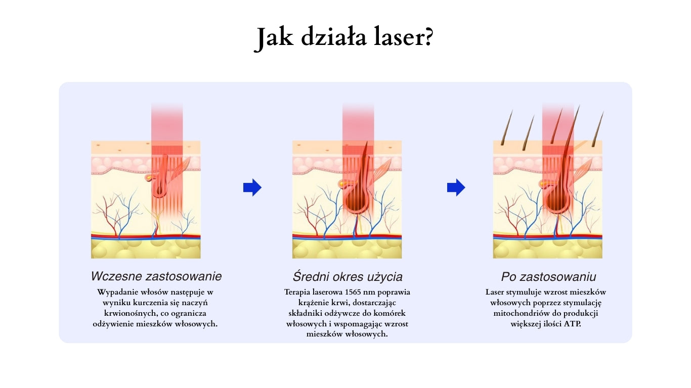 Image Group Revitelis - Laser 1565nm