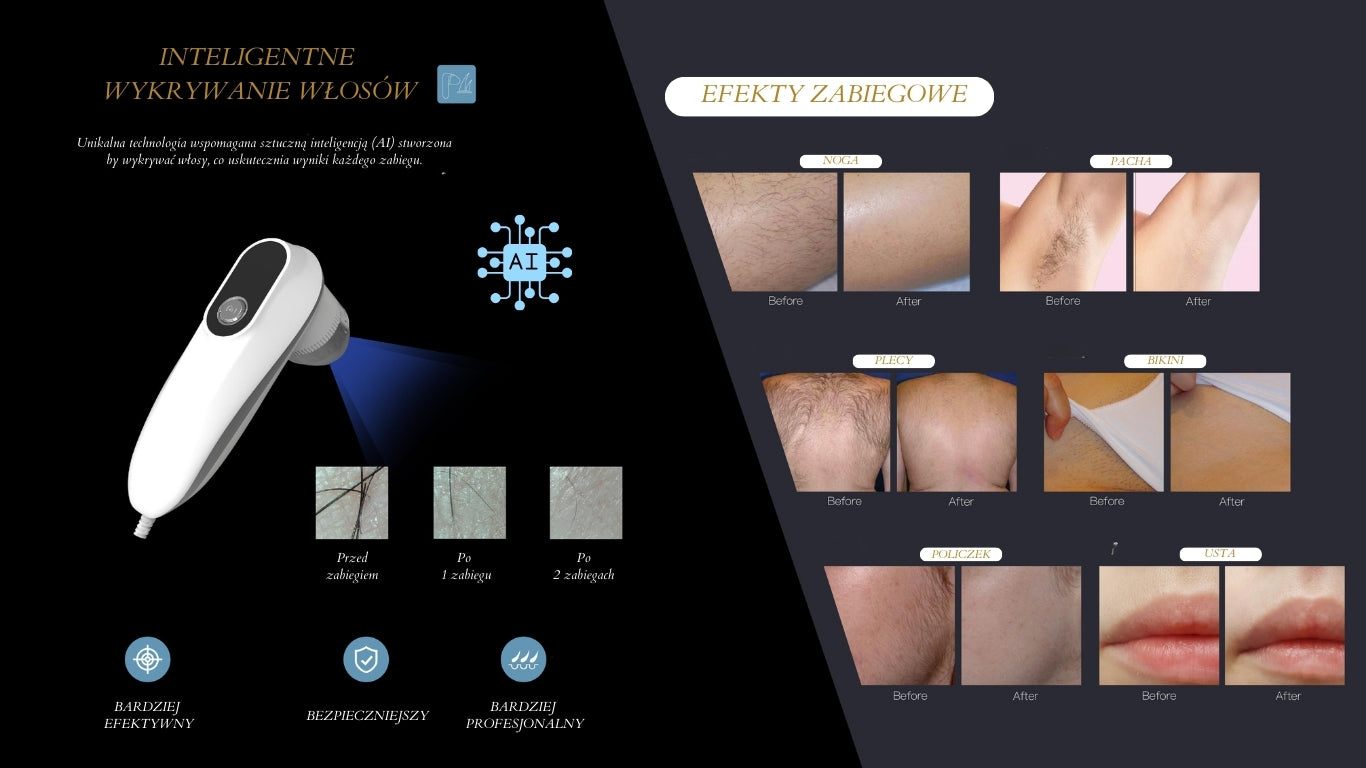 Light Speed Power Puls New - Laser Diodowy Do Epilacji