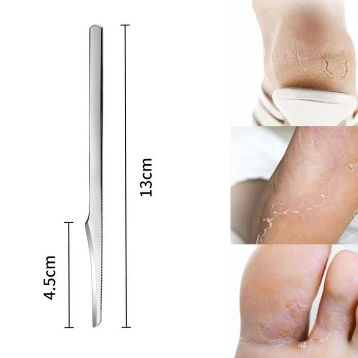 Skrobak do stóp ścinak nożyk do pedicure ze stali nierdzewnej