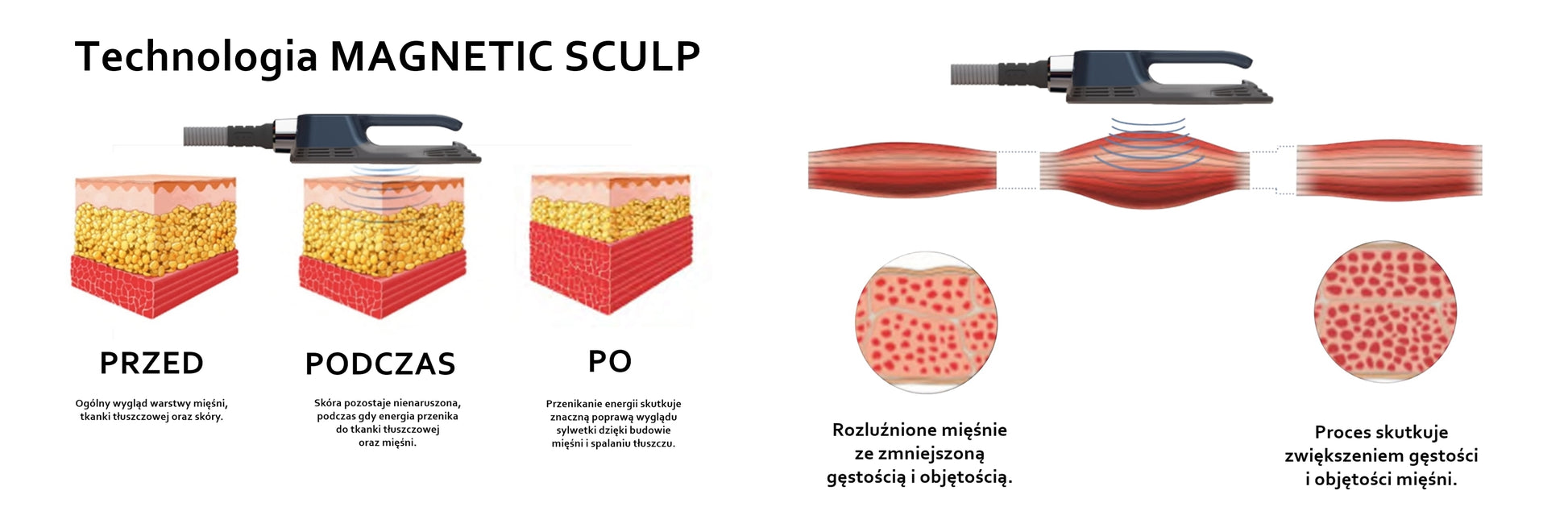 Urządzenie Kosmetyczne - Magnetic Sculp 4H Elektromagnetostymulacja (Wersja Nablatowa)
